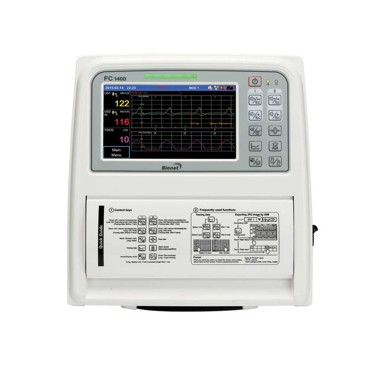 MONITOR FETALE