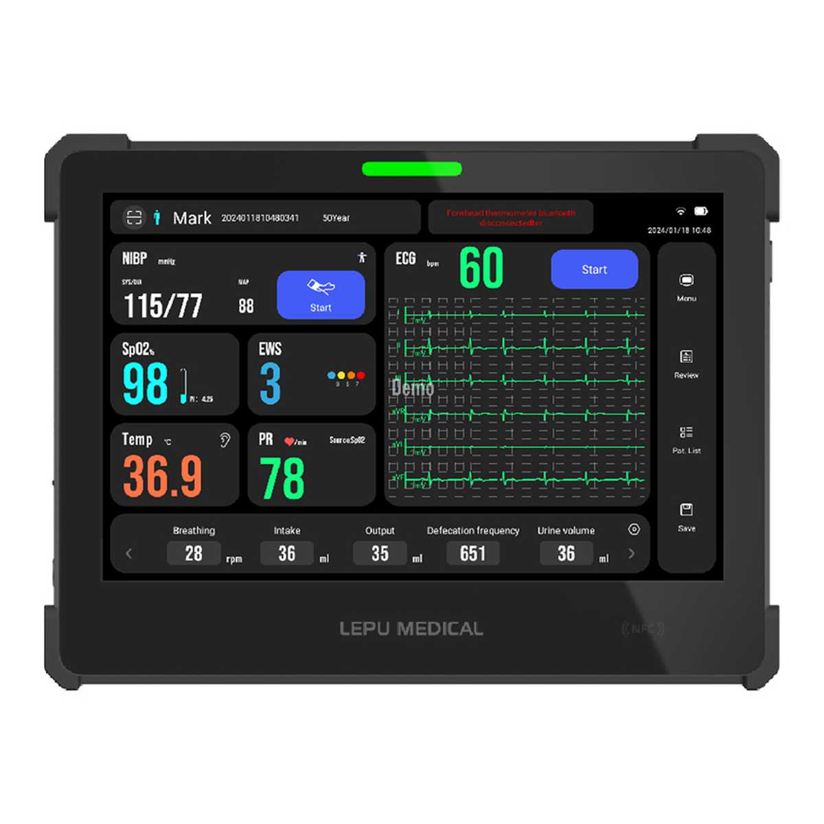 MONITOR SEGNI VITALI AIVIEW VS TABLET